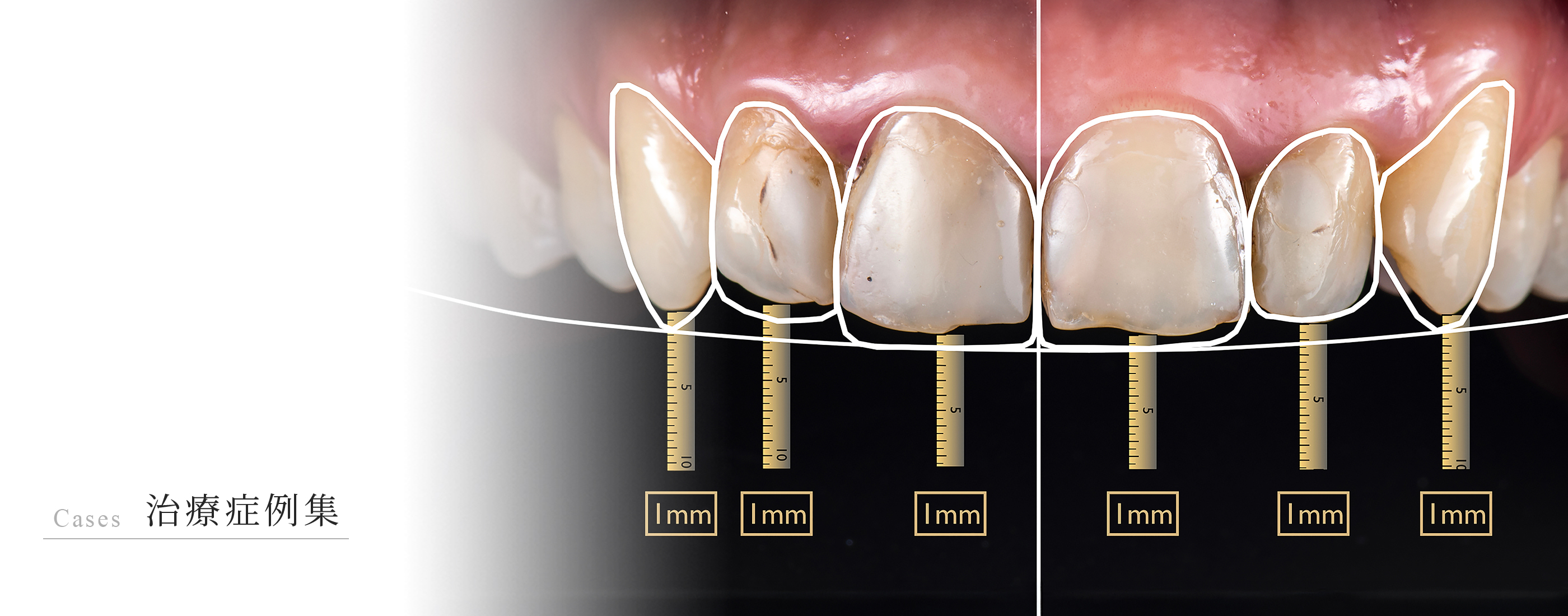 キービジュアル