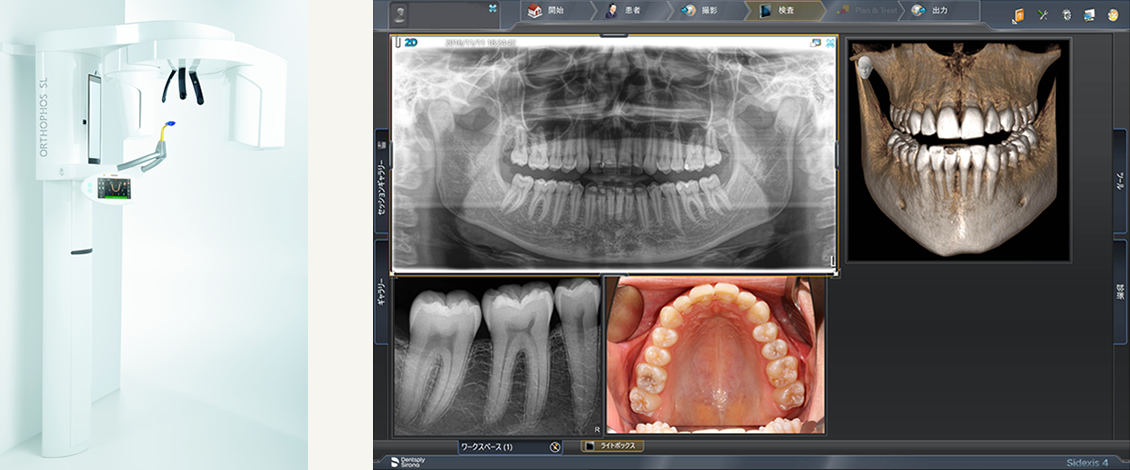 デンツプライシロナ製の最新CTを導入しました